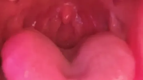 LT-333 webcam model stream image