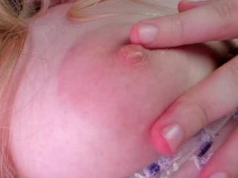 teeencute bongacams stream image